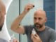 Studiuesit krijojnë serum që rigjeneron flokët — rezultatet janë të pabesueshme!