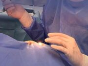 Në Retina Institute, eksperti i Glaukomës Dr. Talay ka nisur ndërhyrjet e veçanta