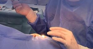 Në Retina Institute, eksperti i Glaukomës Dr. Talay ka nisur ndërhyrjet e veçanta