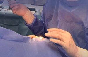 Në Retina Institute, eksperti i Glaukomës Dr. Talay ka nisur ndërhyrjet e veçanta