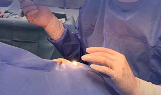 Në Retina Institute, eksperti i Glaukomës Dr. Talay ka nisur ndërhyrjet e veçanta