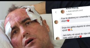 “Fize, të dëshiroj si i çmendur” – Motra e Fredi Lamajt thyen heshtjen