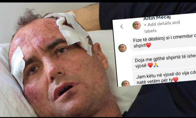 “Fize, të dëshiroj si i çmendur” – Motra e Fredi Lamajt thyen heshtjen