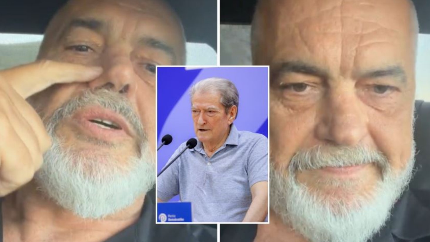 Berisha për hundën e Ramës: “Agresori u arrestua, por procesi gjyqësor nuk u ndoq, ishte një krim pasioni”