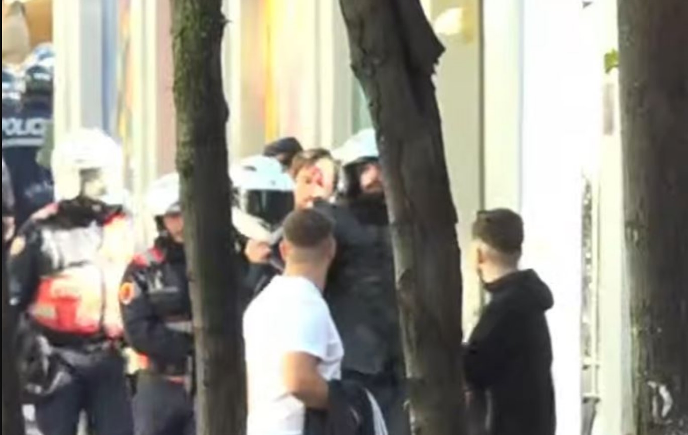Tensione masive te Ministria e Arsimit/ Policia nis shoqërimet pas përplasjeve fizike, shoqërohen disa protestues